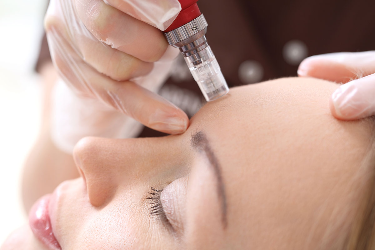 mole_removal